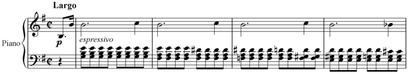 Sheet music of the prelude Op. 28, No. 4.